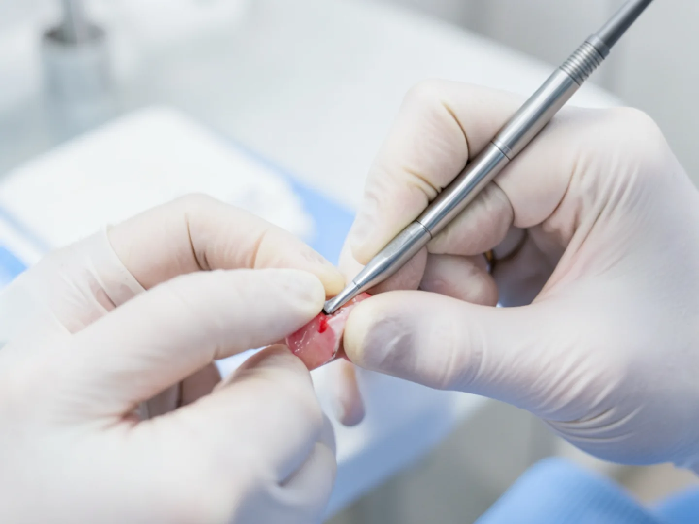 Dental hygienist using gentle ultrasonic scaling for coastal patient